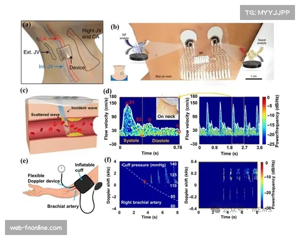 实验室报告：新型可穿戴设备可更准确测量球员急停急转时的肌肉负荷